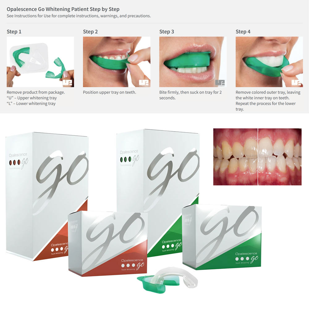 Teeth Whitening Gel Opalescence - Opalescência ir dentes branqueamento bandejas, pré-preenchido