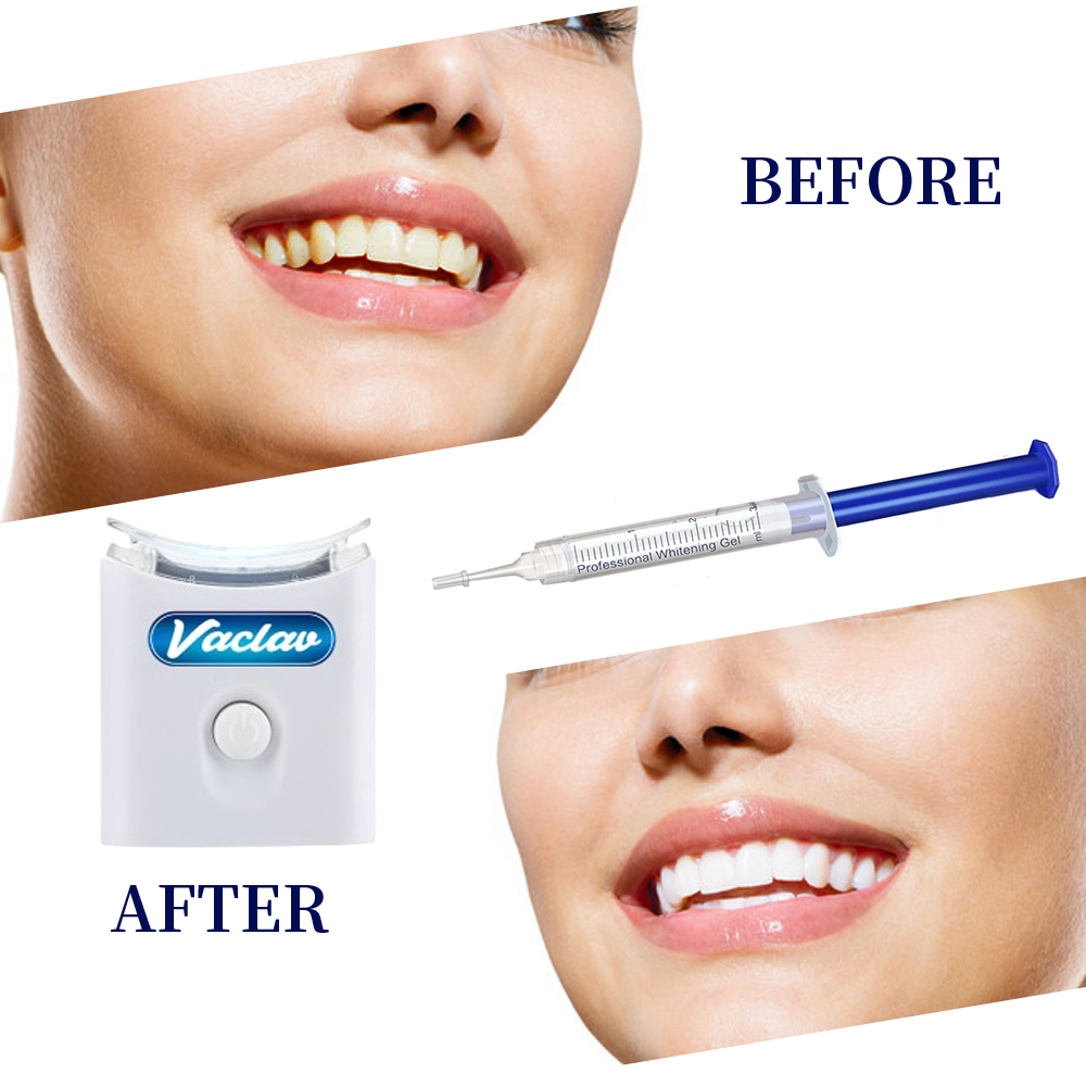 Seringa de gel para clareament - Teeth Whitening Gel Syringes avaliação e preço