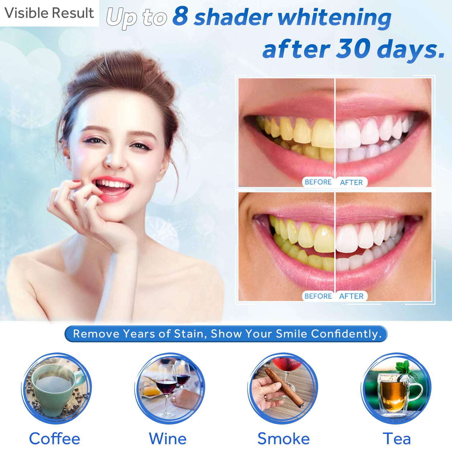 Seringa de recarga de gel para - Teeth Whitening Gel Syringes avaliação e preço