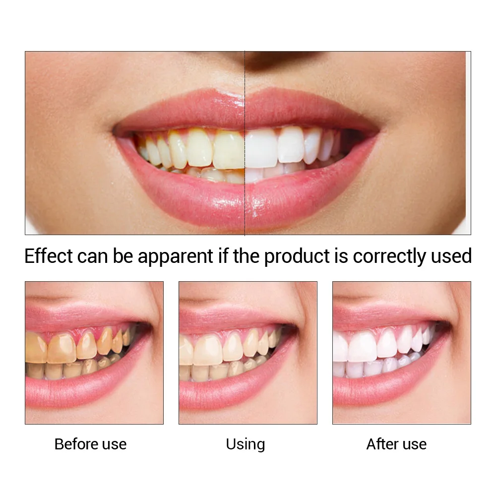 FTEENPLY Essência para claream - Teeth Paint Whitening avaliação e preço