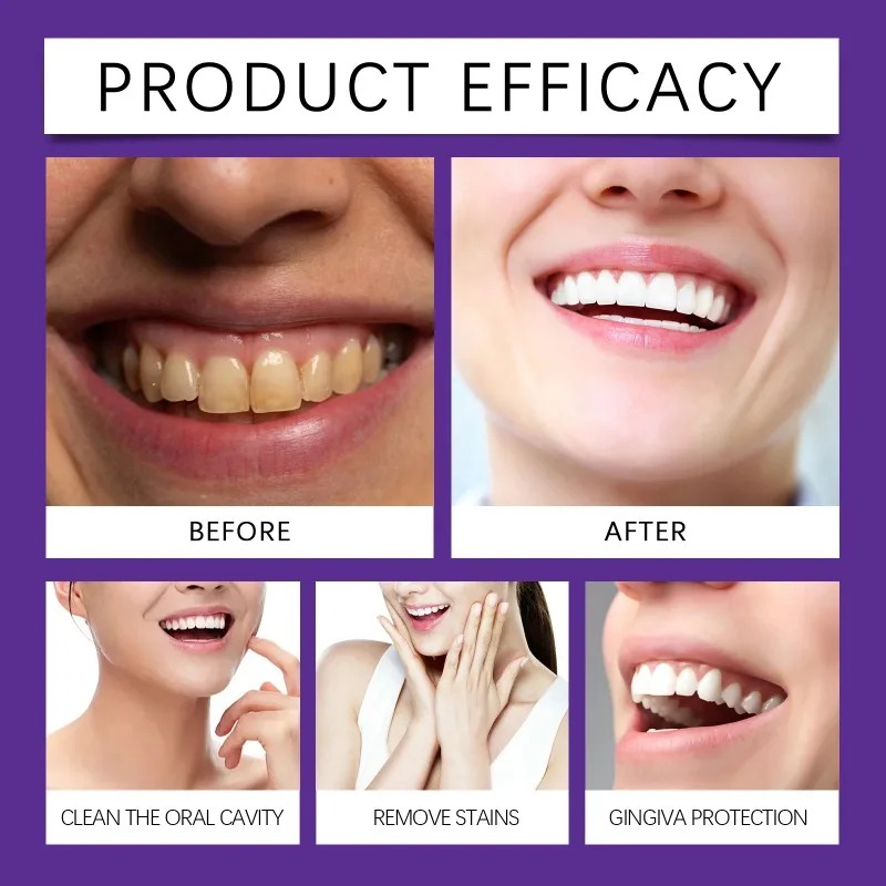 Pó Mineral Restaurador de Dent - Teeth Paint Whitening avaliação e preço
